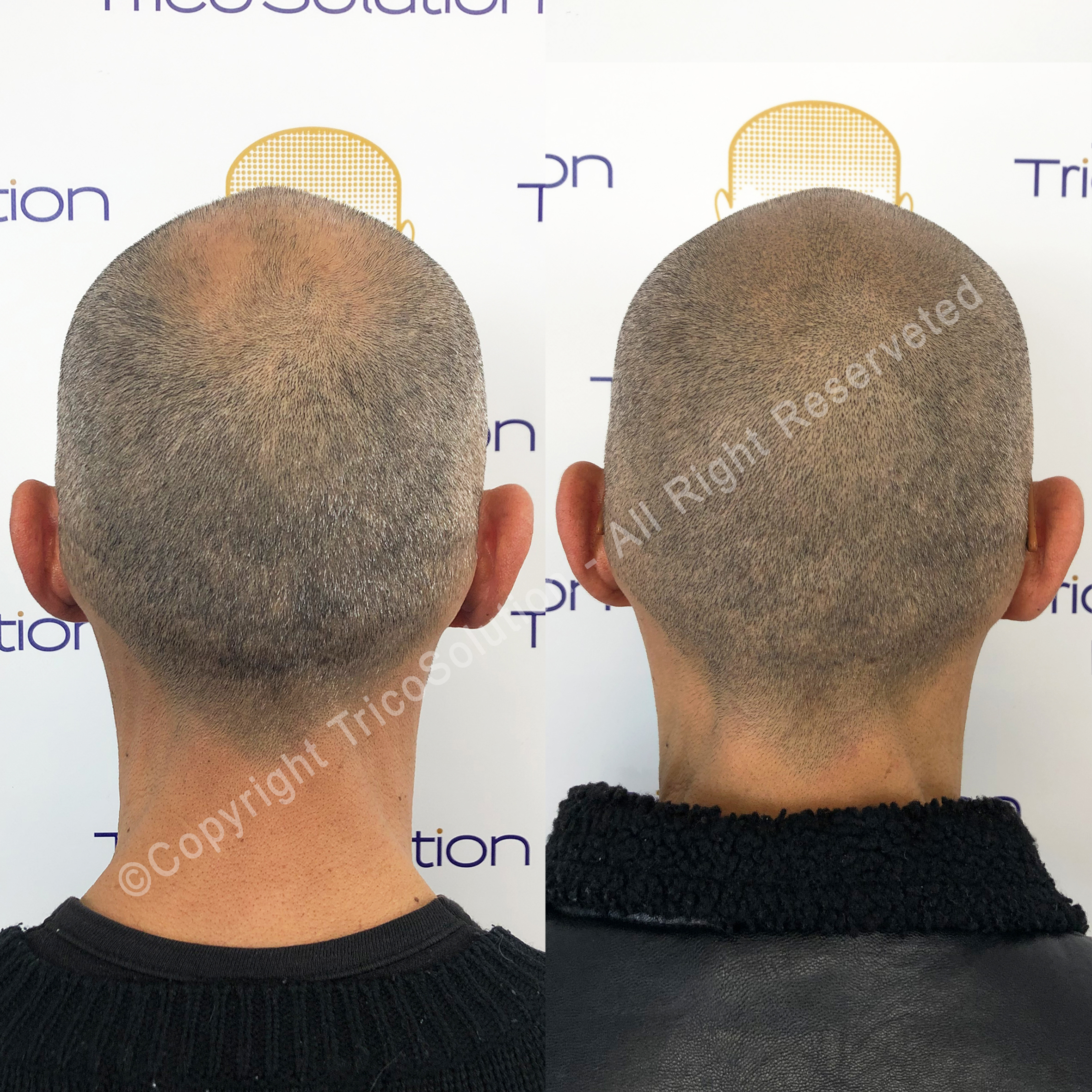 Effetto Rasato โ TricoSolution