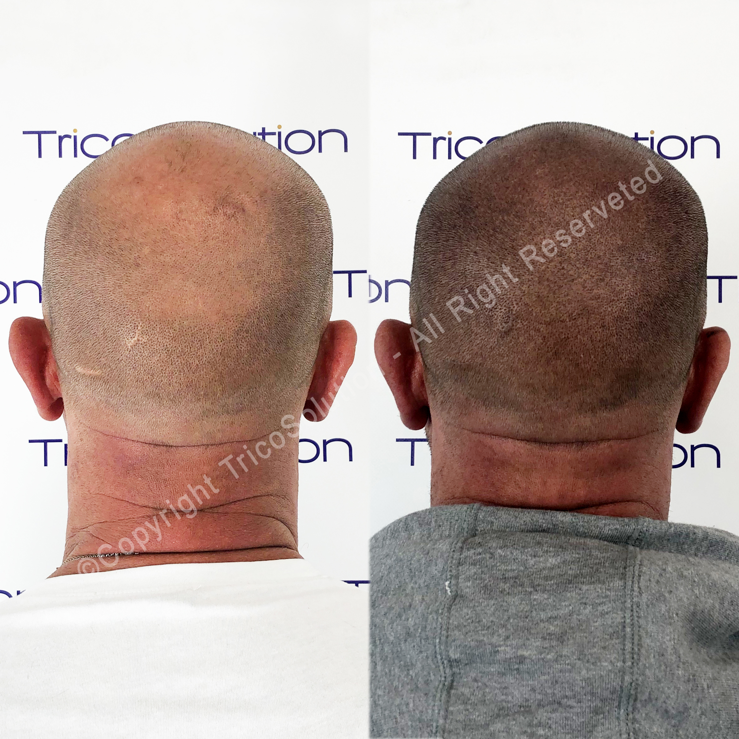 Effetto Rasato โ TricoSolution