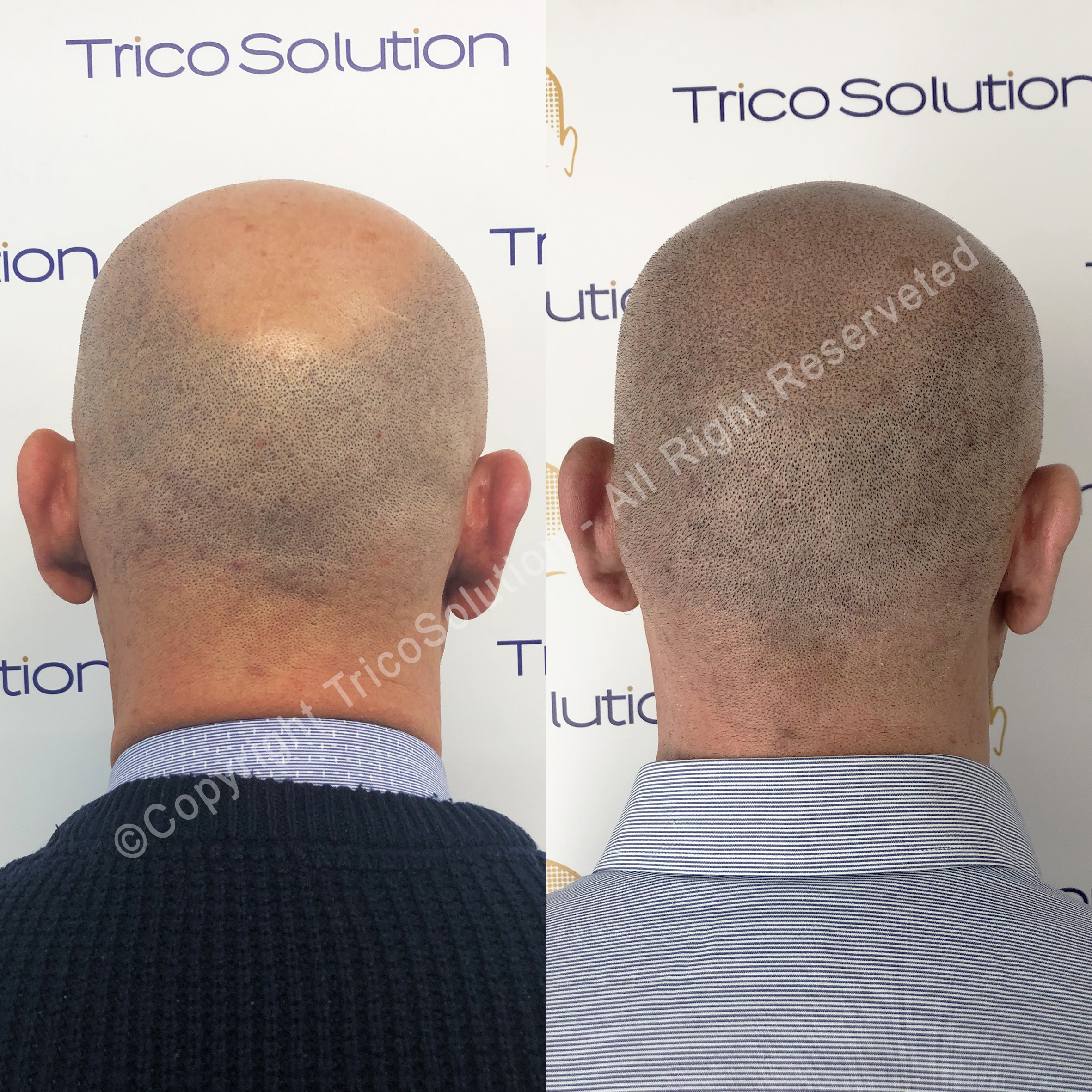 Effetto Rasato โ TricoSolution